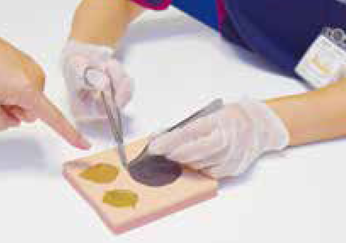 細密な模型を使って、褥瘡の壊死部分切除のトレーニング